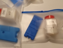 Анализ воды после модуля УФ обеззараживания